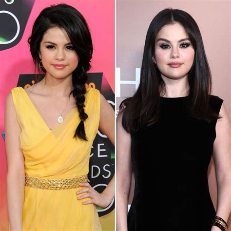 did selena gomez get boob job|Selena Gomez & Plastic Surgery: Experts Claim She .